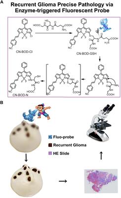 Enhanced γ-Glutamyltranspeptidase Imaging That Unravels the Glioma Recurrence in Post-radio/Chemotherapy Mixtures for Precise Pathology via Enzyme-Triggered Fluorescent Probe